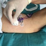 Los equipos de terapia intravenosa (ETI), opción segura de gestión del cuidado vascular